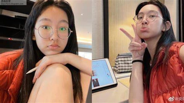 不掩飾臉上瑕疵！美靚女網紅出道1年擁109萬粉絲 非完美更吸引 LIHKG 討論區